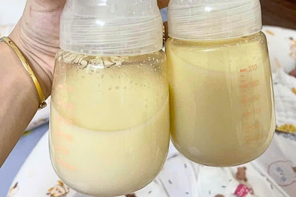 Phân biệt màu sữa mẹ an toàn và dấu hiệu cần cảnh giác- Ảnh 1.